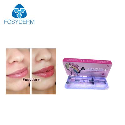 Заполнителей губы Fosyderm 2ml линия Derm впрыски повышения губы дермальных Hyaluronic кисловочная